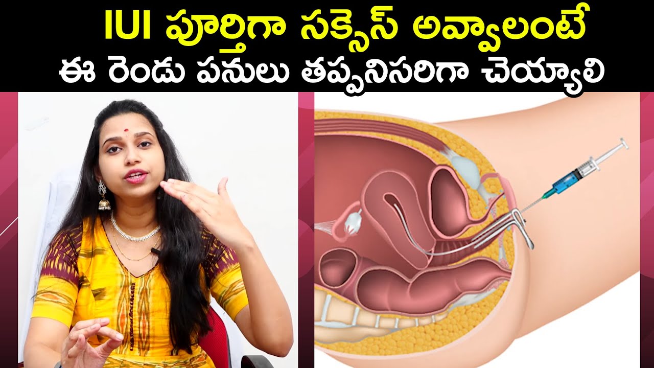What Precautions are to be Taken After IUI Treatment | Dr. Shruthi | Ferty9 Fertility Hospital