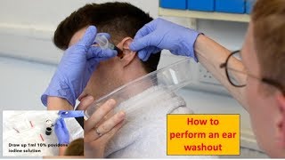 How to Perform an Ear Washout (irrigation) - ENT/Otolaryngology Skills screenshot 2