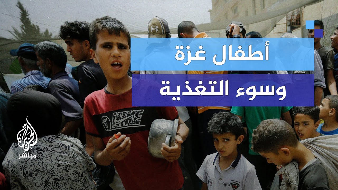 الأونروا: 50 ألف طفل في غزة يعانون من سوء التغذية الحاد