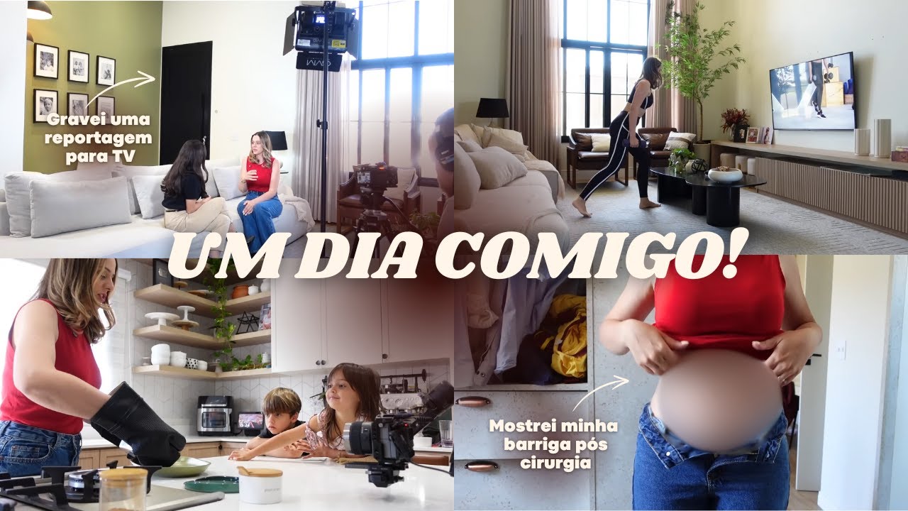 RESULTADO DA MINHA CIRURGIA PÓS 1 ANO + Gravei uma reportagem para TV + meu dia como influenciadora