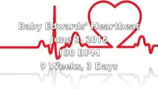 Baby&#39;s Heartbeat