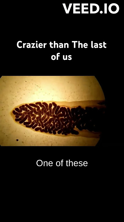 Creepy but real brain controlling parasite - Lancet fluke part 2 #science #medicine #veterinary