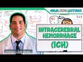 Intracerebral Hemorrhage (ICH): Etiology, Pathophysiology, Clinical Features, Diagnostics, Treatment