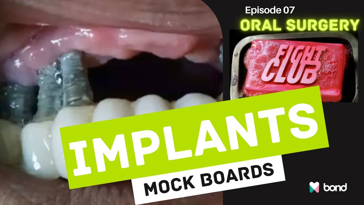 Oral Surgery Fight Club – Season 1 Episode 7 - Implants