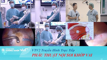 KỸ THUẬT MỔ NỘI SOI KHỚP VAI - KHÂU GÂN CHÓP XOAY