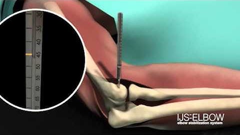 IJS - Elbow Animation by Skeletal Dynamics