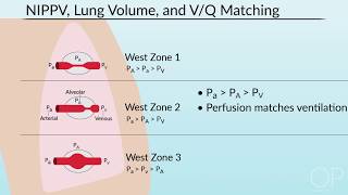 Pulmonary Mechanics in NonInvasive Positive Pressure Ventilation by B. McAlvin | OPENPediatrics