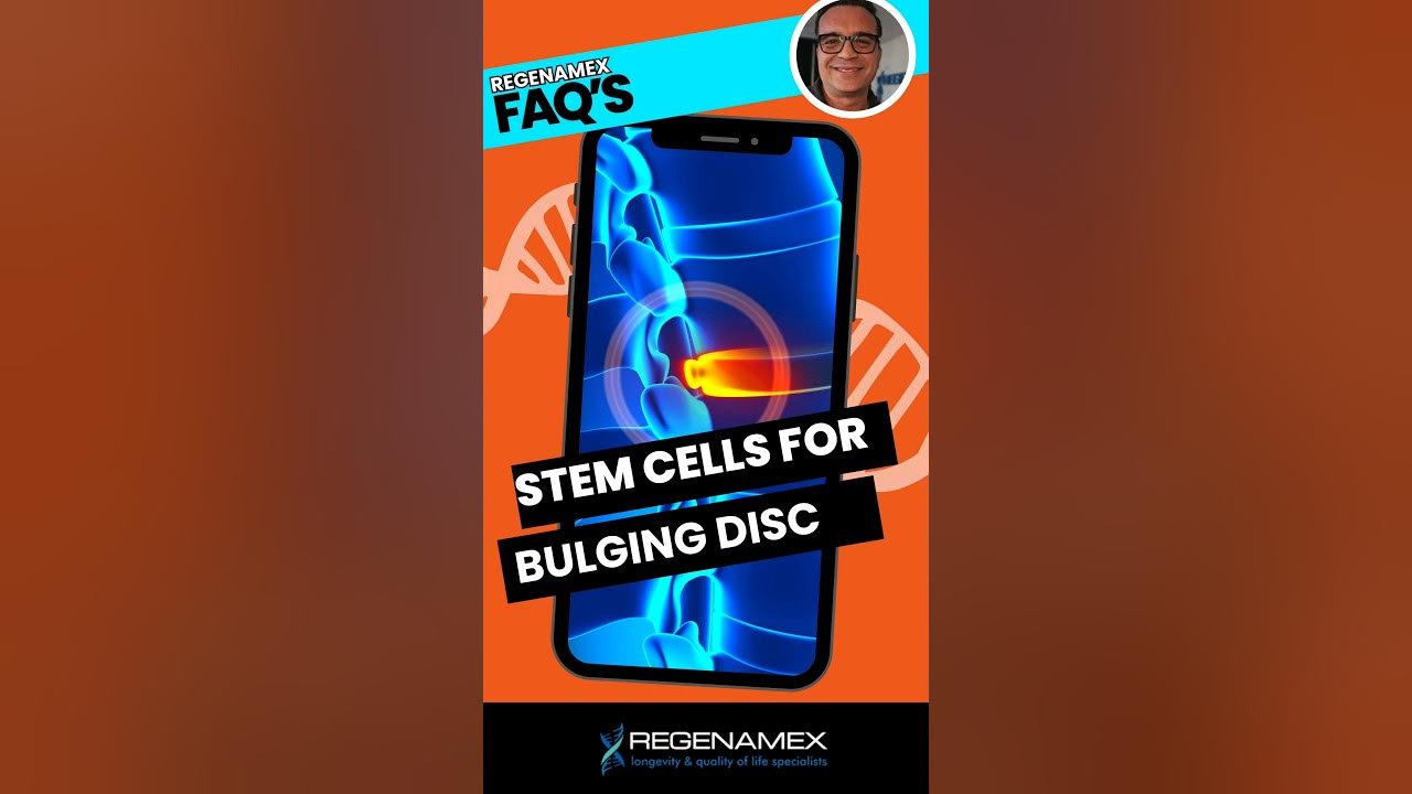 how-to-treat-bulging-disc-in-lower-back-youtube