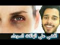 حل حديث نهائي للتخلص من الهالات السوداء للأبد دكتور احمد اشرف