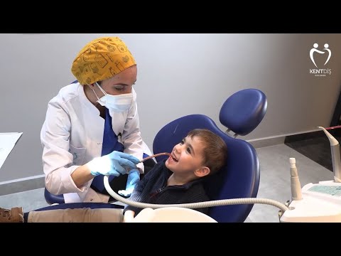 KENTDİŞ - Çocuklarda diş hekimi muayenesi