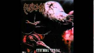 Pyaemia - Impaled on Stakes