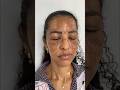 Easy To Remove Pigmentation Darkspots in Just 2Days💥 Clear Glowing Skin.#foryou #pigmentation #viral