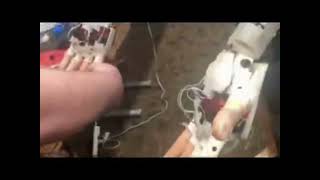 Robot Lab fingers
