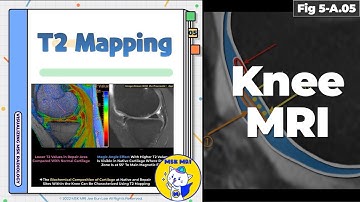 (Fig 5-A.05) T2 Mapping Techniques