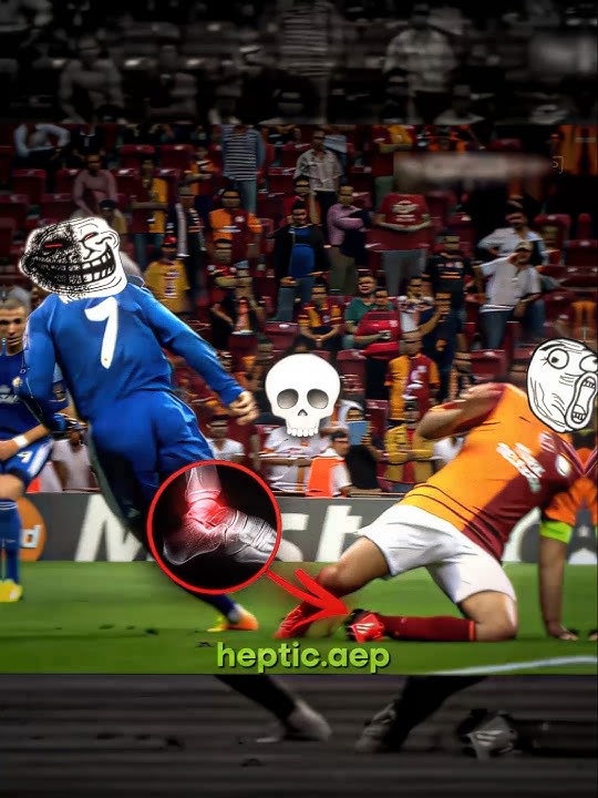 Ronaldo's Dribbling Broke His Ankle💀#ronaldo #footballedits #fyp #viral #shorts #cristiano #cr7 #4k