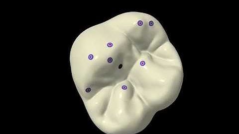 How to use 2 step technique for Occlusion (Bausch)