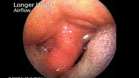 Chapter 13: 03 ARTICULATION: Flutter Tonguing