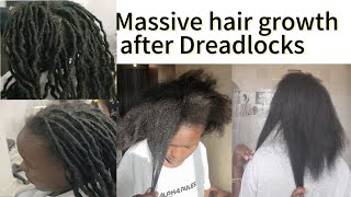 Removing artificial dreadlocks of 8 Months || Massive Hair Growth || Protect your hair || Best style