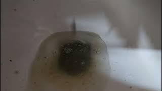 diarrhea vid for 100 subs!