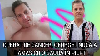 Am avut o tumora cat o portocala! Georgel Nuca a scapat de cancer dar a ramas cu o gaura in piept