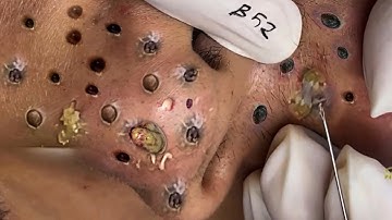 Enjoy Every Day With The Best Video Loan Nguyen Spa Official | 914