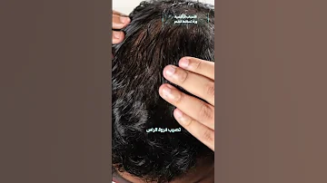 الأسباب الرئيسية وراء تساقط الشعر 