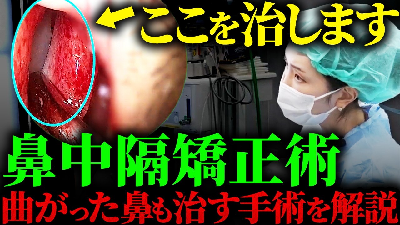 閲覧注意】日帰りでできる鼻中隔矯正術の手術を徹底解説！#耳鼻科
