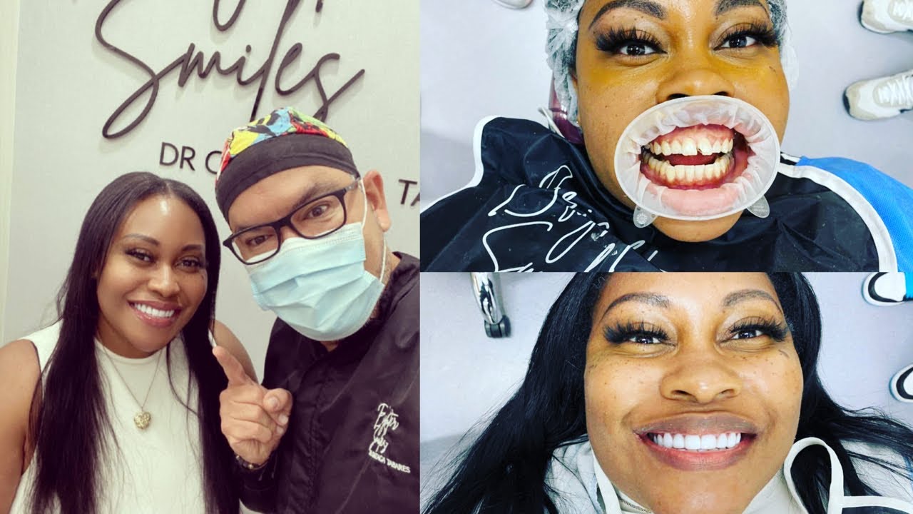 WATCH ME GET VENEERS | Dr. Gonzaga Tabares | Cali, Colombia 🇨🇴