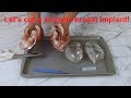 LET&#39;S CUT A SILICONE BREAST IMPLANT