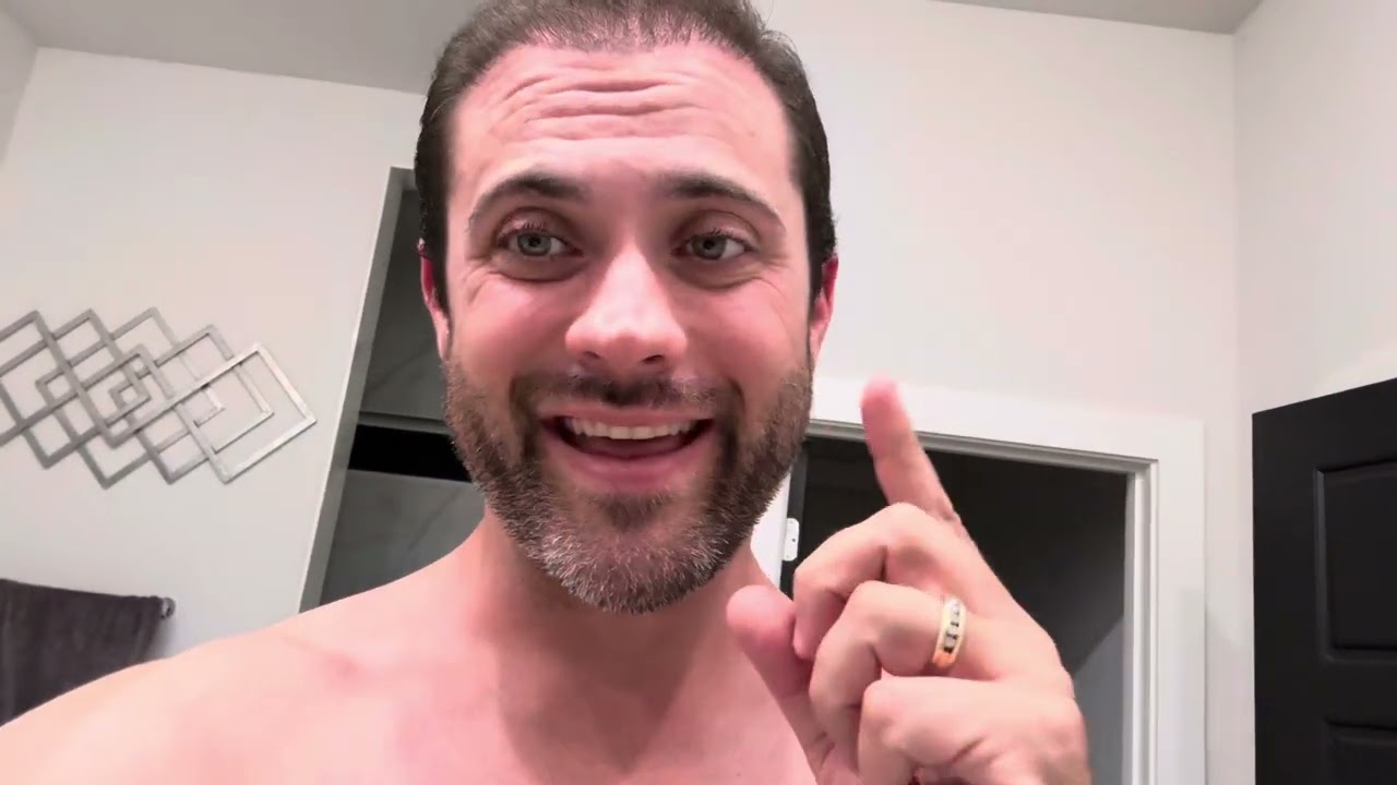 Hair transplant – Cosmedica – Istanbul, Turkey - 3 months post-op