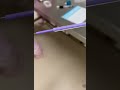 Disposable Medical Urinary Catheter Glue Injection and UV lED light Curing all in one machine.