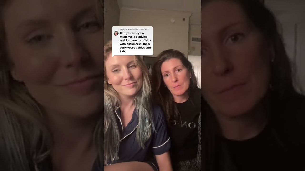 My Mom Gives Advice on Having a Child with a Vascular Birthmark 