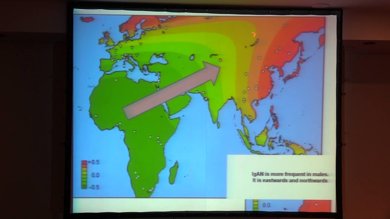 Nefrología: Hallazgos histopatológicos en Nefropatía IgA: factores de riesgo de progresión argentina futbol
