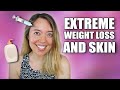 Skin CHANGES and CARE After EXTREME WEIGHTLOSS