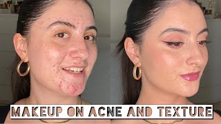 MAKEUP APPLICATION ON ACNE AND TEXTURED SKIN | How Makeup Looks In Real Life | Unfiltered Makeup