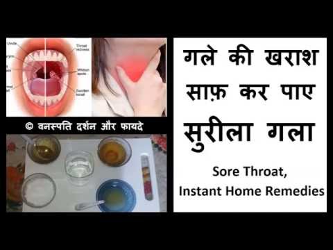 गले की खराश साफ़ कर पाए सुरीला गला Gale Ki Khraash Kaise Door Karen With English Subtitle