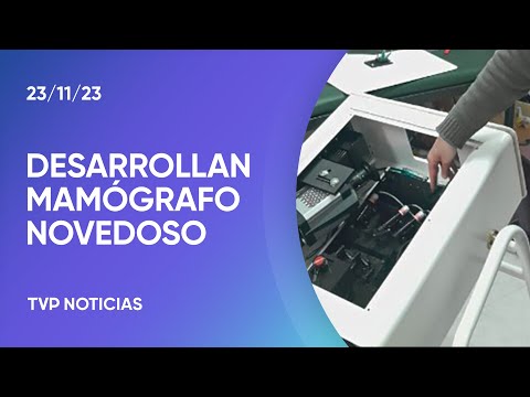 Investigadores argentinos desarrollaron un mamógrafo único en el mundo