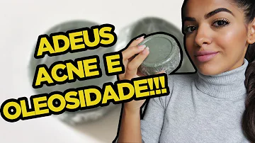 Como fazer sabonete para acne caseiro?