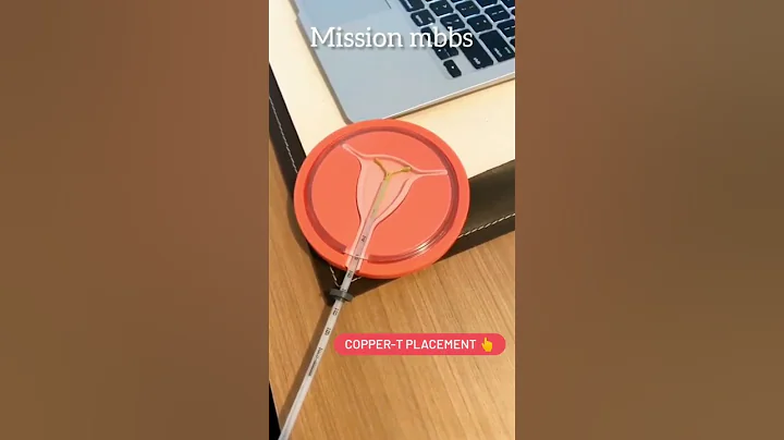 Copper T placement | Reproductive health | #biology #easyunderstanding #easyway #theory #neet2023