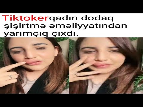 Tiktoker qadın dodaq şişirtmə əməliyyatından yarımçıq çıxdı.