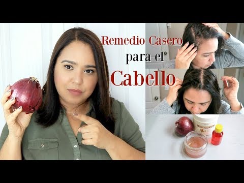 Vídeo: Jugo De Cebolla Para El Cabello: ¿puede Detener La Pérdida De Cabello?