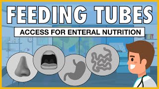 Types of Feeding Tubes EXPLAINED screenshot 4