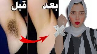 كنز رباني لإزالة شعر الوجه والجسم كله من الجدور??بدون ألم والشعر سوف يسقط ولن يعود نهائيا