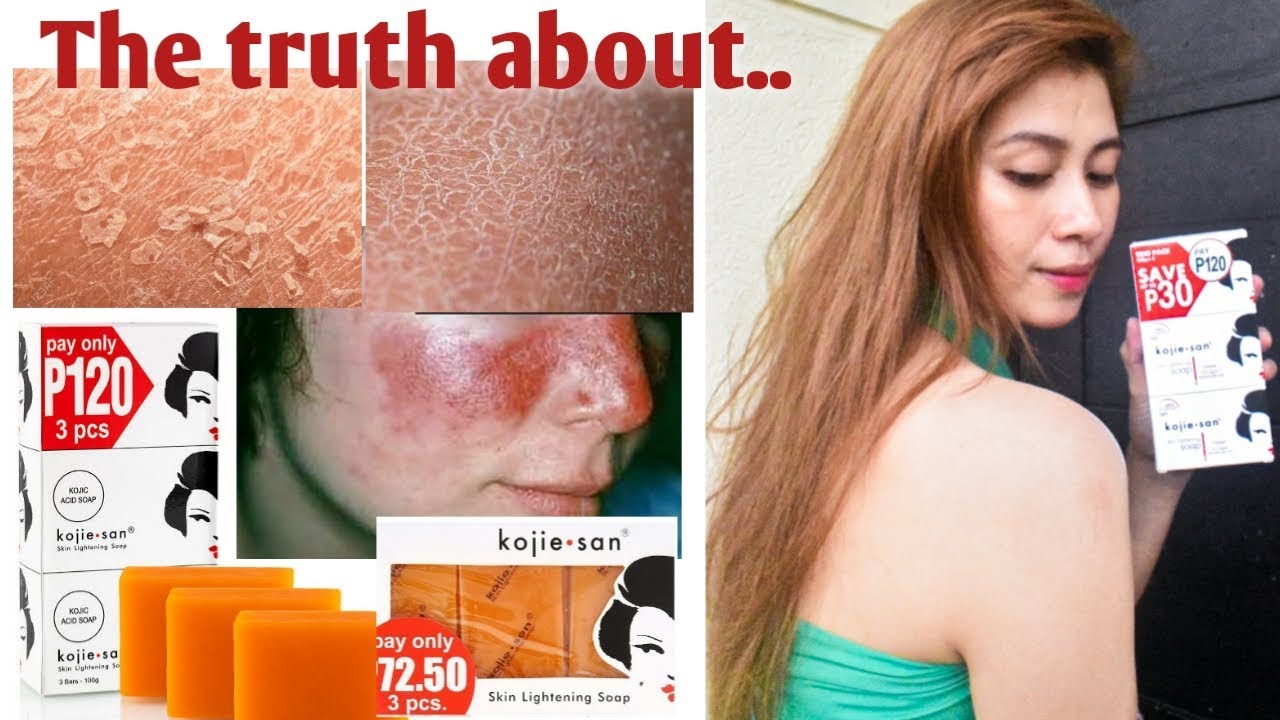 Kojie San Skin Lightening Soap 135g - Addis Ababa - Addis Ababa -
