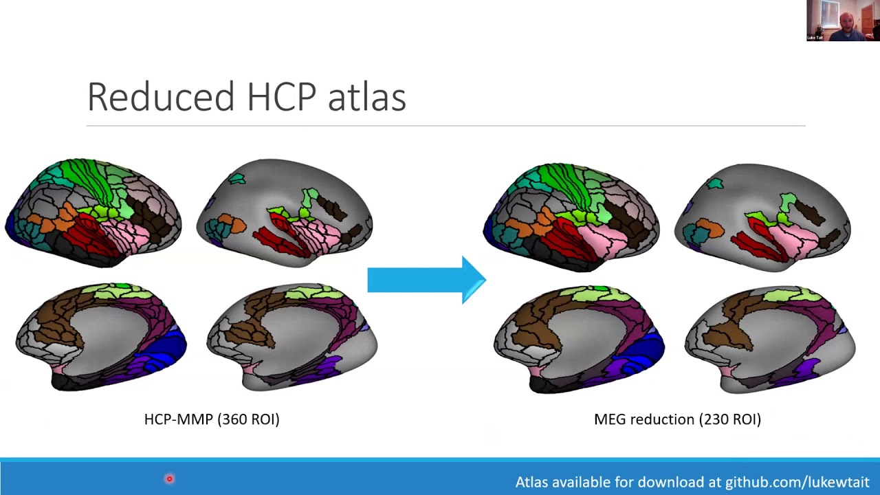 Talk: Towards optimal source reconstruction of resting MEG of the human brain: performance, precisi…