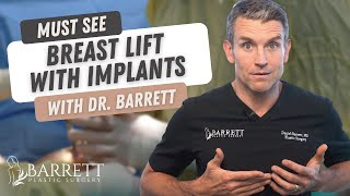 Amazing Breast Lift With Implants! | Barrett Plastic Surgery