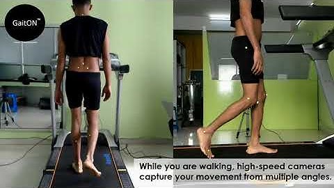 How can gait analysis help you fix your knee, hip, foot or back pain?