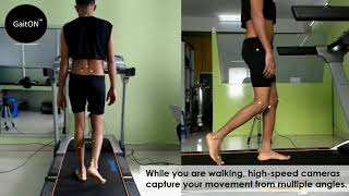 How can gait analysis help you fix your knee, hip, foot or back pain?