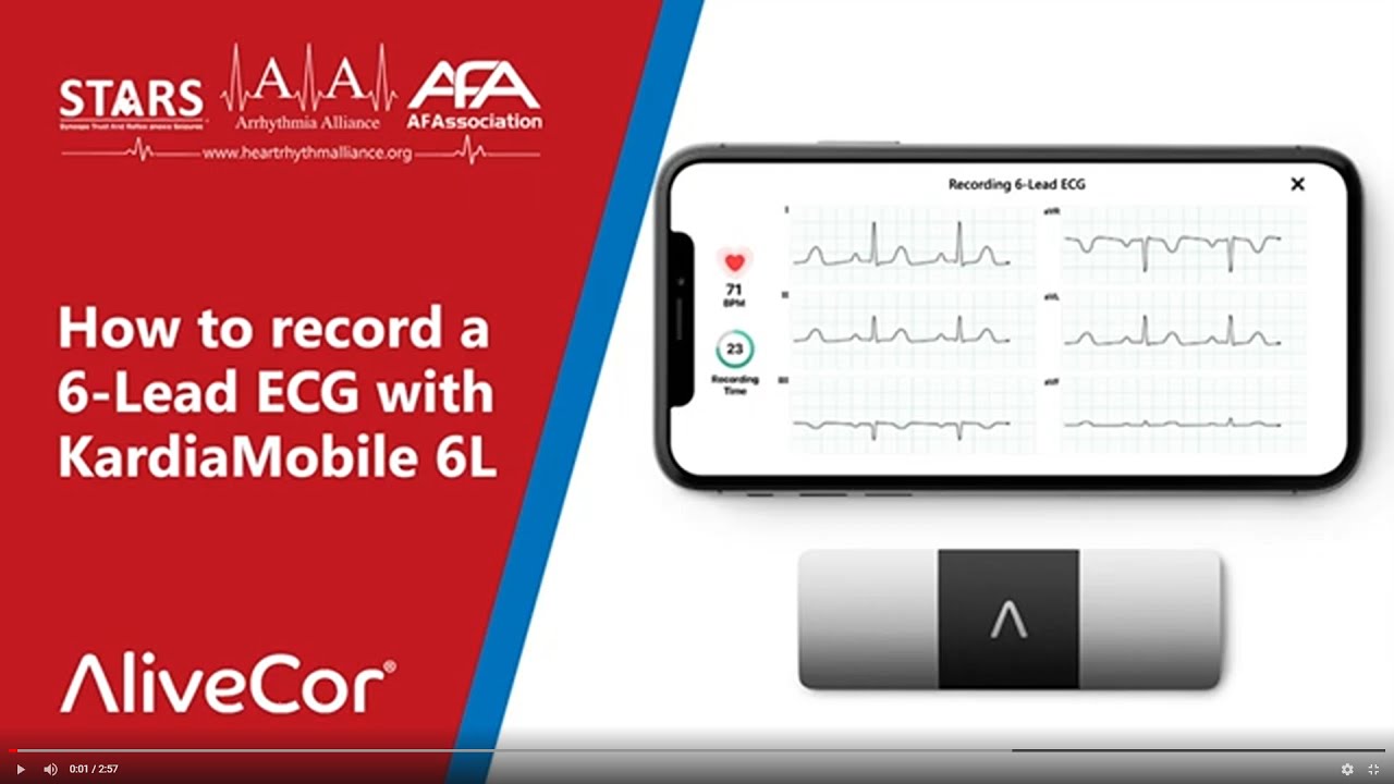 AliveCor® KardiaMobile 6L Heart Monitor - Arrhythmia Alliance - UK