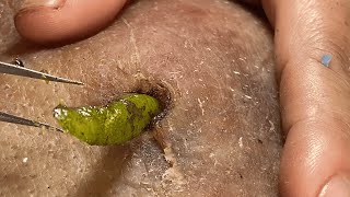 Download Lagu 𝑭𝒂𝒄𝒊𝒂𝒍 𝑪𝒍𝒆𝒂𝒏𝒔𝒊𝒏𝒈 𝑭𝒂𝒄𝒆𝒐𝒇𝒇 𝑴𝒊𝒄𝒆𝒍𝒍𝒂𝒓 𝑾𝒂𝒕𝒆𝒓 𝒗𝒔 𝑪𝒍𝒆𝒂𝒏𝒔𝒊𝒏𝒈 𝑶𝒊𝒍𝒇𝒐𝒓 𝑰𝒏𝒏𝒆𝒓 𝑷𝒆𝒂𝒄𝒆 #1120 MP3